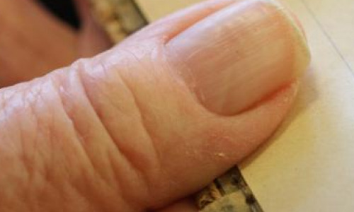 Пенсионерам утвердили доплату в 7107 рублей. Известно, кто ее получит