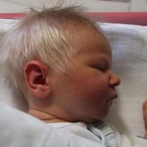 Почему ребенок рождается со светлыми волосами